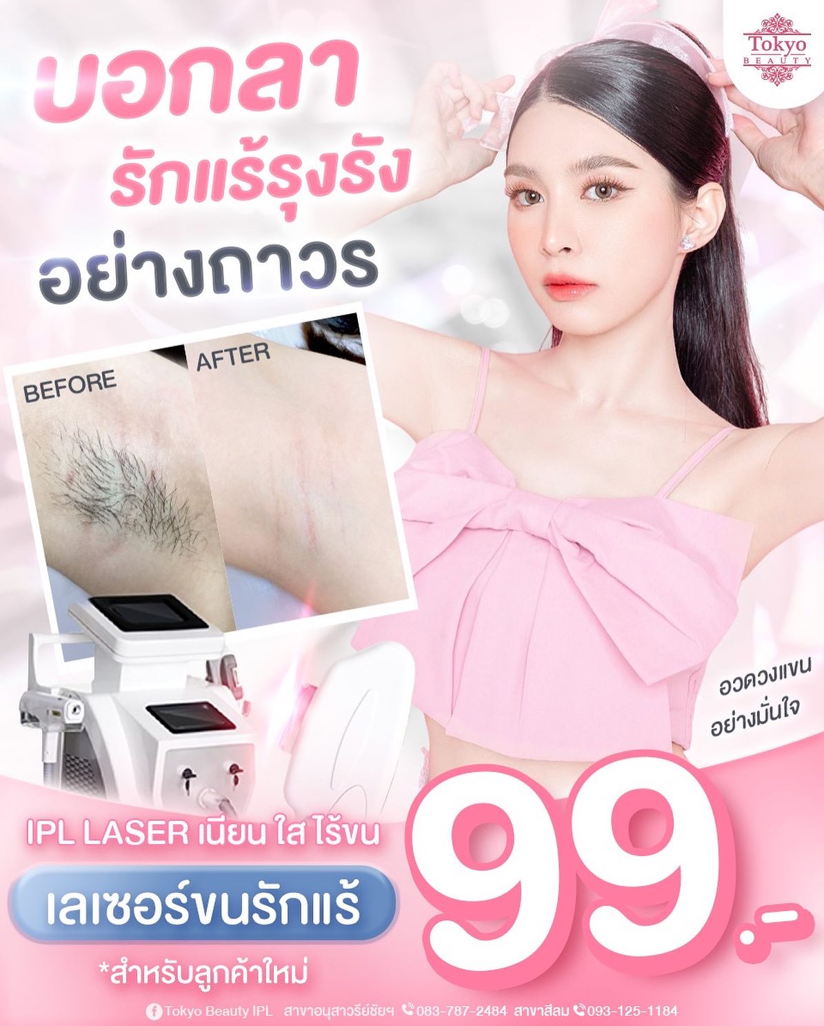 💖 บอกลารักแร้รุงรัง แบบถาวร! ✨ เลเซอร์ขนรักแร้ เพียง 99.- ลูกค้าใหม่เท่านั้น . เครื่อง...