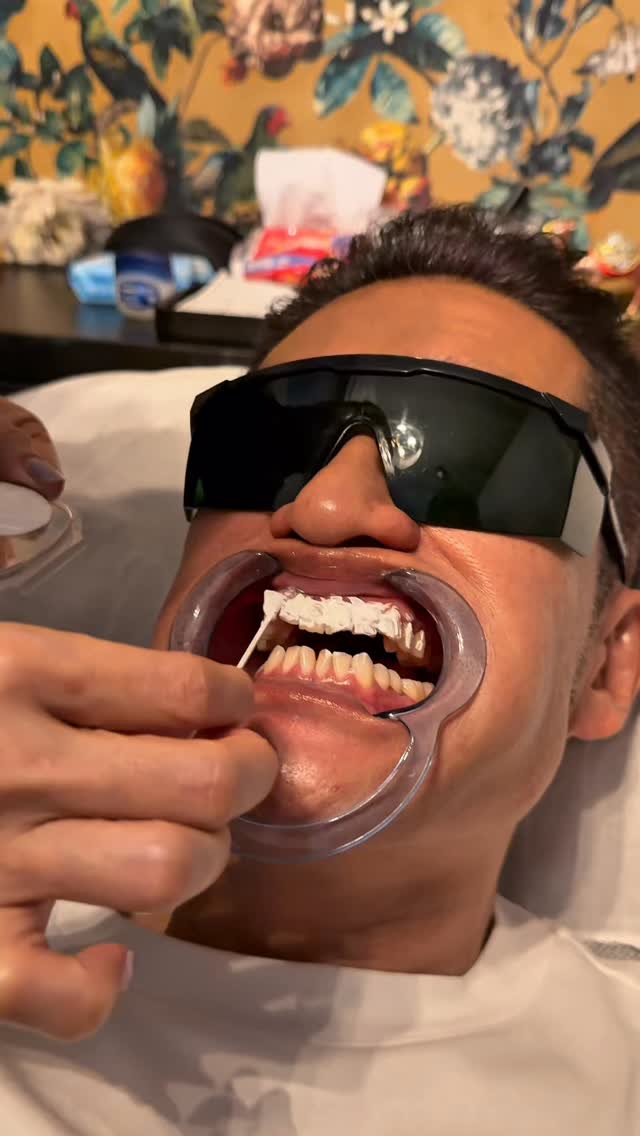 脱毛＆ホワイトニングで“清潔感アップ”。
脱毛はどの部位でもOK、冷却＆出力調整で初めてでも安心。
ホワイトニングは自然にトーンアップして笑顔に。
Before/Afterは動画でチェック！ご予約はDMへ。
※医療行為ではありません／効果には個人差があります。

🇹🇭

ครบจบในครั้งเดียว กำจัดขน + ไวท์เทนนิ่ง
กำจัดขนได้ทุกส่วน ปรับระดับและมีระบบทำความเย็น มือใหม่ก็สบายใจ
ไวท์เทนนิ่งโทนอัพอย่างเป็นธรรมชาติ ยิ้มมั่นใจขึ้น
ชม Before/After ในวิดีโอ แล้วทัก DMเพื่อนัดคิวได้เลย
ไม่ใช่การรักษาทางการแพทย์ ผลลัพธ์แตกต่างกันไป

#ホワイトニング
#脱毛
#ฟอกสีฟัน
#ฟันขาว
#ยิ้มมั่นใจ