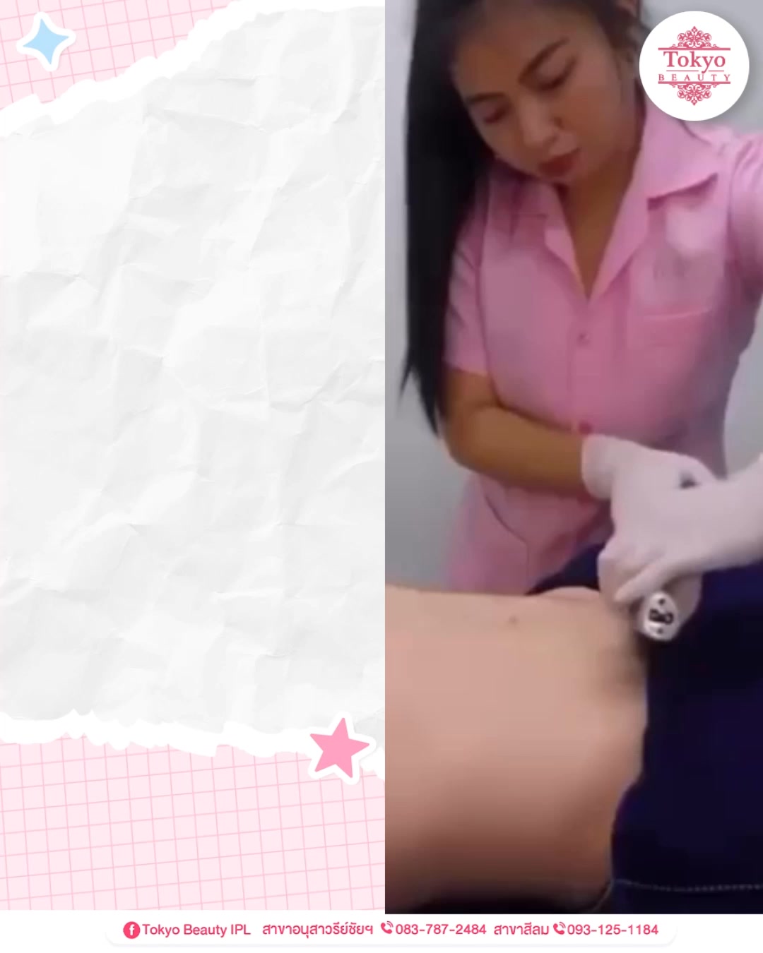 พอไม่มีขน...ก็มั่นใจขึ้นจริง 👀
✨ โปรแกรม IPL Lase VIO ราคา 999.-
🎁 1 ครั้ง แถม 1 ครั้ง คุ้มเว่ออออร์
( เข้ารับบริการภายใน ม.ค. 69 )
.
• ขนบางลง ผิวเรียบเนียน 
• ลดปัญหาขนคุดและหนังไก่
• จุดซ่อนเร้นดูสะอาดขึ้น
.
ใครอยากตรงนั้นเนียน ทักจองคิวด่วน!
💌 INBOX m.me/152264661912195
===========================
สาขาอนุสาวรีย์ชัยฯ (BTS อนุสาวรีย์ชัยฯ)
📞 083-787-2484
สาขาสีลม (BTS สีลม)
📞 093-125-1184
===========================
#TokyoBeauty #คลินิกอนุสาวรีย์ #เลเซอร์ขนบิกินี่ #เลเซอร์ขนใกล้BTS #เลเซอร์ขนใกล้รถไฟฟ้า #โปรเลเซอร์ขน #เลเซอร์ขนราคาถูก #เลเซอร์ขนVIO