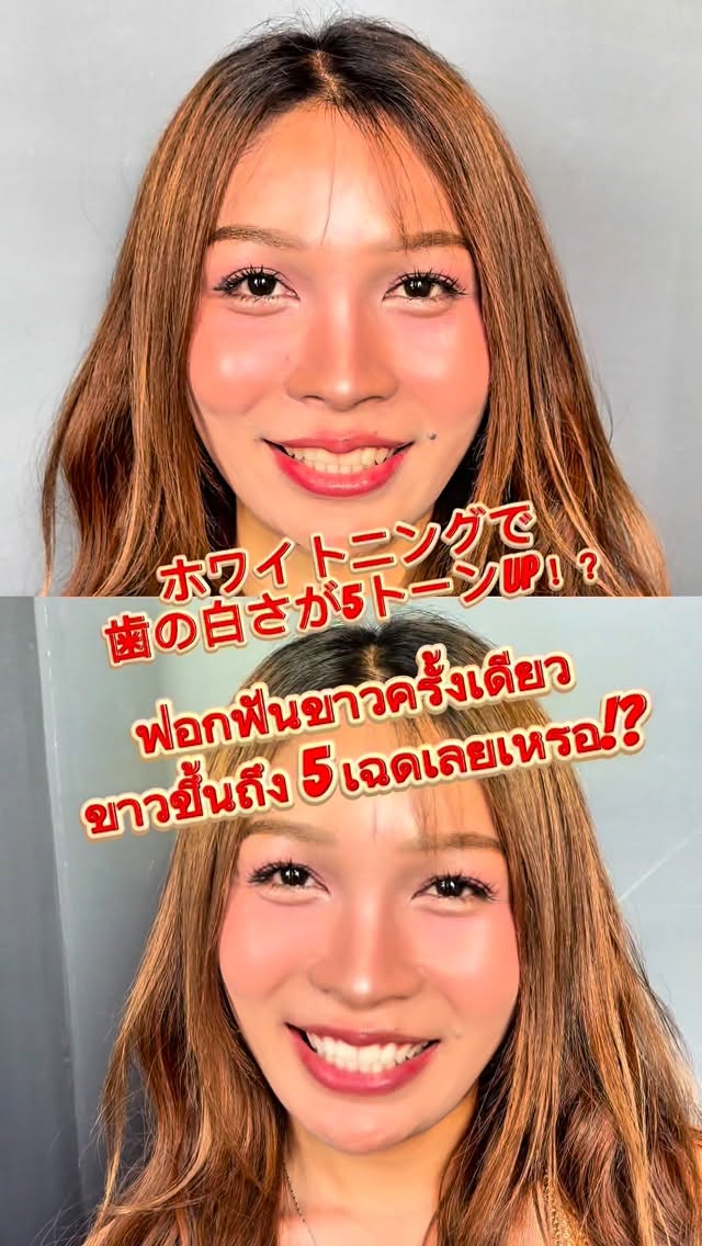 ฟันคือชีวิต! 🦷✨
แค่ฟันสะอาดสวย…
ภาพลักษณ์แรกก็เปลี่ยนได้ทันที!

อยากลองเปลี่ยนชีวิตด้วยการฟอกสีฟันไหมคะ?

ฟันขาวขึ้น…ยิ่งดูสวยขึ้นไปอีก! 🤍

มือใหม่ก็สบายใจได้ค่ะ
แทบไม่เจ็บ ผ่อนคลายระหว่างทำได้เลย
(ความรู้สึกแตกต่างกันไปในแต่ละบุคคล)

ใครที่ดูแลฟันแค่ด้วยยาสีฟันอย่างเดียว
แนะนำให้ลองมาสักครั้งนะคะ!

タイ語に翻訳して

歯は命！
歯が綺麗なだけで、
第一印象が変わる！

ホワイトニングで、
人生変えてみませんか！？

歯が白くなれば、
更に美しくなる！

初めてのホワイトニングでも安心！
痛み0でリラックスして受けていただけます！

歯磨き粉でしか、
歯の手入れをしていない方！
ぜひ一度お越しください！

#salondesix #whitening