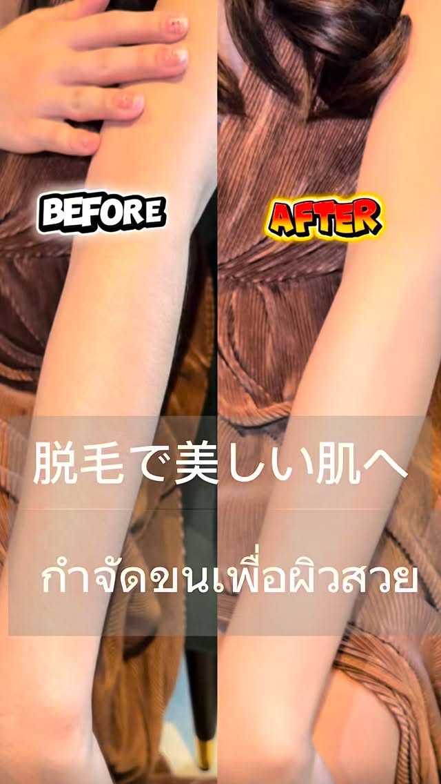 กำจัดขนแล้วเปลี่ยนได้ขนาดนี้! ✨
ยุคนี้ทั้งผู้ชายและผู้หญิงก็ทำกำจัดขนกันแล้ว
มามีผิวสวยเนียนไปด้วยกันนะคะ!

เราดูแลอย่างละเอียด และใช้เทคโนโลยี SHR ที่แทบไม่เจ็บ
เพื่อกำจัดขนได้อย่างทั่วถึงทุกจุดค่ะ

ทำกำจัดขนแล้ว
มารับผิวเนียนน่าสัมผัส เสริมความมั่นใจกันค่ะ!

脱毛でこれだけ変わる！
今は男も女も脱毛時代！
美しい肌を手に入れよう！

丁寧な施術と痛みの無いSHR脱毛で隅々まで脱毛していきます！

脱毛して、
モテ肌を手に入れよう！

#脱毛 #ツルツル肌 #ムダ毛ケア 
#กำจัดขน #ฟอกสีฟัน