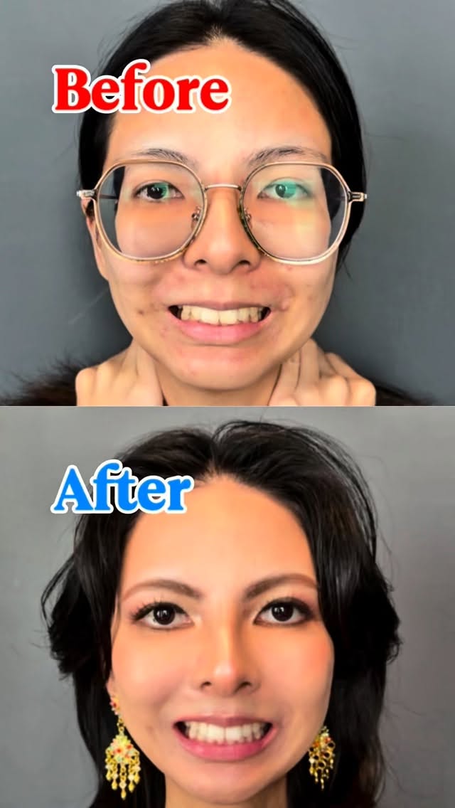 脱毛サロン•サロン・デ・シックス Salon de Six/歯のプレミアムホワイトニング エクシアバンコク